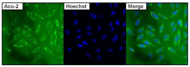 Aconitase 2 Antibody in Immunocytochemistry (ICC/IF)