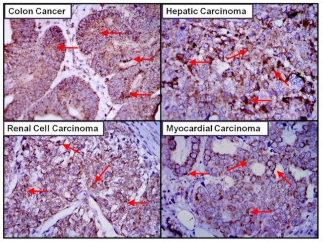 Aconitase 2 Antibody in Immunohistochemistry (Paraffin) (IHC (P))