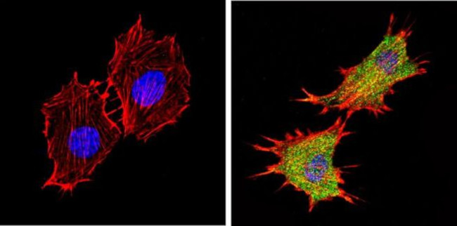 AKT2 Antibody in Immunocytochemistry (ICC/IF)