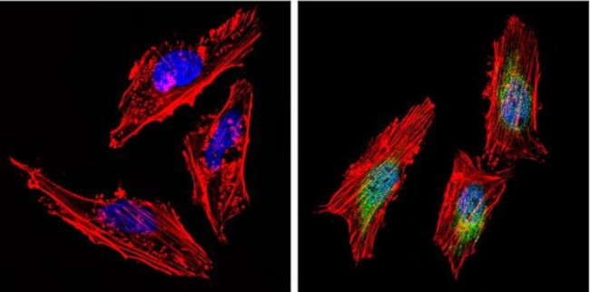 AKT2 Antibody in Immunocytochemistry (ICC/IF)