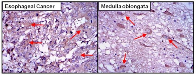 AKT2 Antibody in Immunohistochemistry (Paraffin) (IHC (P))