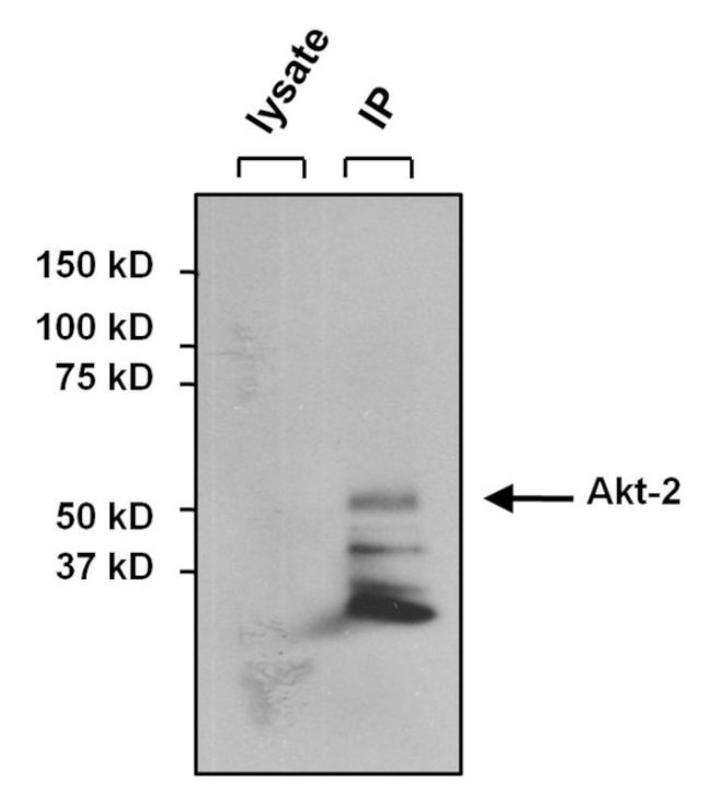 AKT2 Antibody in Immunoprecipitation (IP)