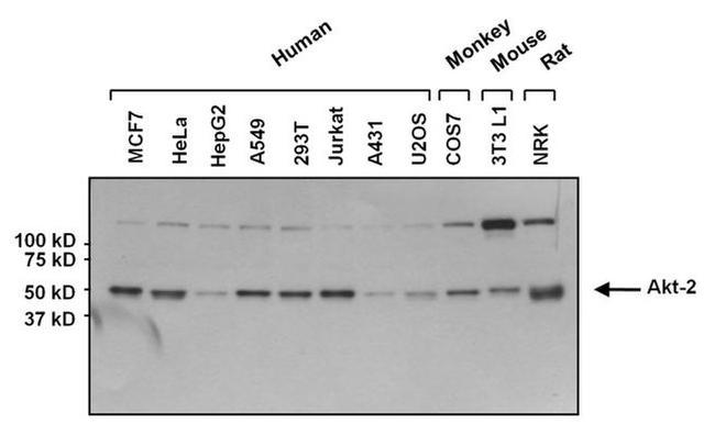 AKT2 Antibody in Western Blot (WB)