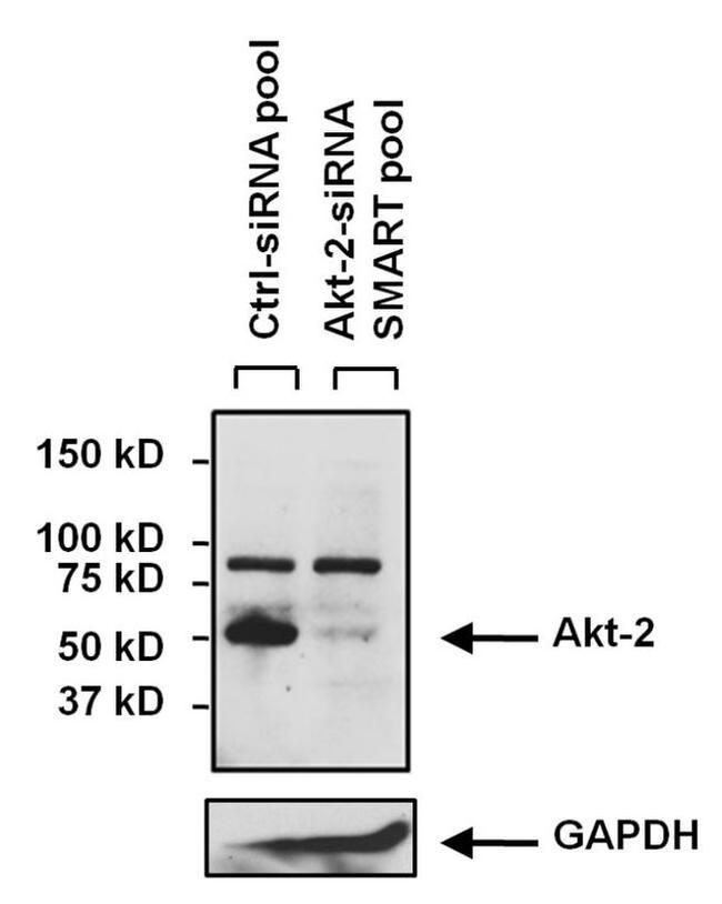 AKT2 Antibody in Western Blot (WB)