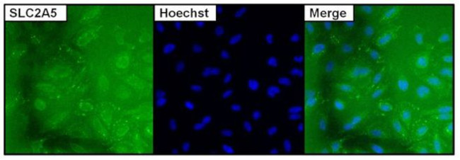 SLC2A5 Antibody in Immunocytochemistry (ICC/IF)