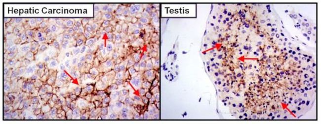 SLC2A5 Antibody in Immunohistochemistry (Paraffin) (IHC (P))