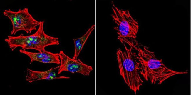 STAT1 Antibody in Immunocytochemistry (ICC/IF)