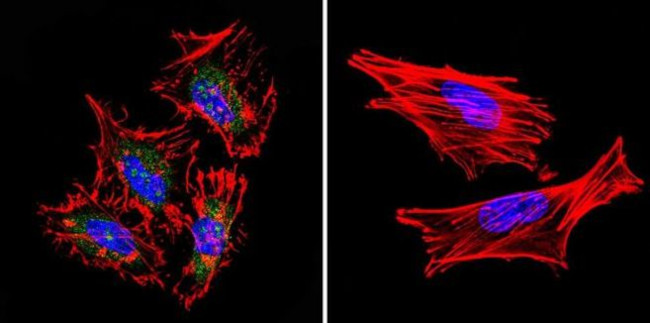 STAT1 Antibody in Immunocytochemistry (ICC/IF)