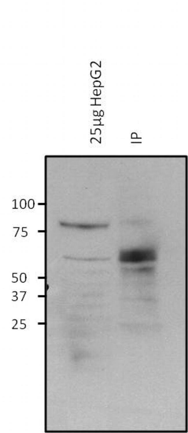 O-linked N-acetylglucosamine (O-GlcNAc) Antibody in Immunoprecipitation (IP)