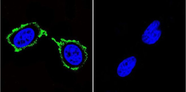 PSD-95 Antibody in Immunocytochemistry (ICC/IF)