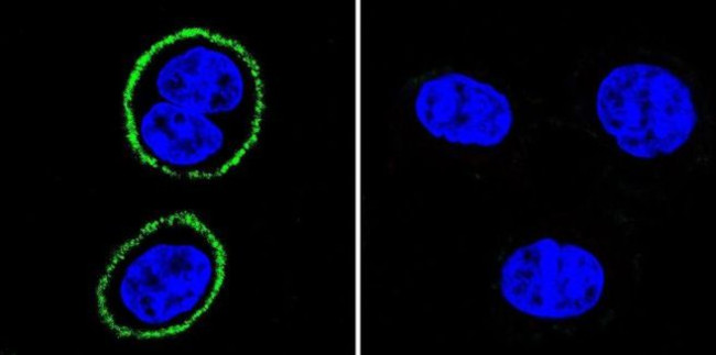 PSD-95 Antibody in Immunocytochemistry (ICC/IF)