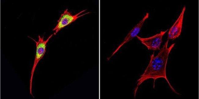 Cytohesin 1 Antibody in Immunocytochemistry (ICC/IF)