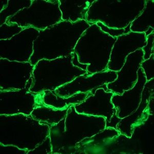 Laminin Antibody in Immunohistochemistry (Frozen) (IHC (F))