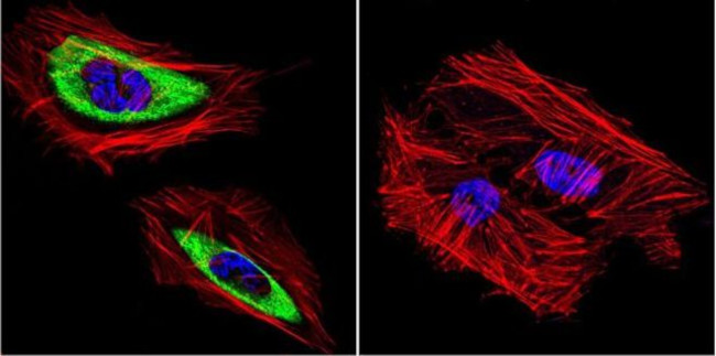 Cytohesin 2 Antibody in Immunocytochemistry (ICC/IF)