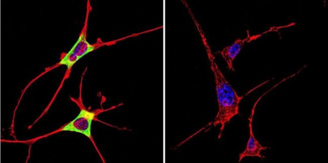 Cytohesin 2 Antibody in Immunocytochemistry (ICC/IF)