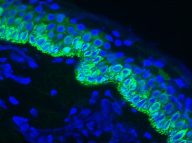 Cytokeratin 14 Antibody in Immunohistochemistry (Frozen) (IHC (F))