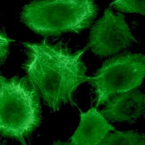 Cytokeratin 17 Antibody in Immunocytochemistry (ICC/IF)