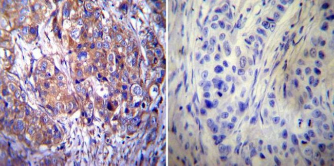 Clathrin Heavy Chain Antibody in Immunohistochemistry (Paraffin) (IHC (P))