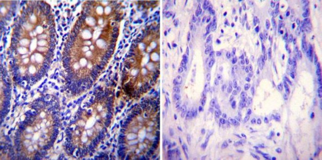 Clathrin Heavy Chain Antibody in Immunohistochemistry (Paraffin) (IHC (P))