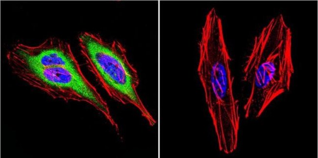 Dynein Antibody in Immunocytochemistry (ICC/IF)