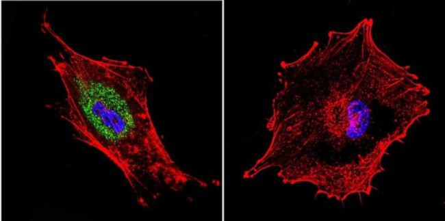 Dynein Antibody in Immunocytochemistry (ICC/IF)