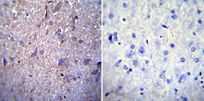 NUP62 Antibody in Immunohistochemistry (Paraffin) (IHC (P))