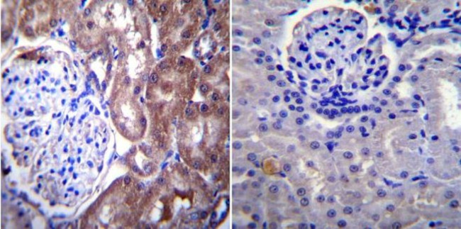 NUP62 Antibody in Immunohistochemistry (Paraffin) (IHC (P))