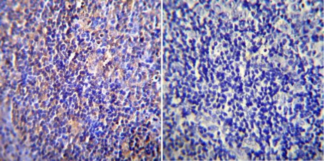 NUP62 Antibody in Immunohistochemistry (Paraffin) (IHC (P))