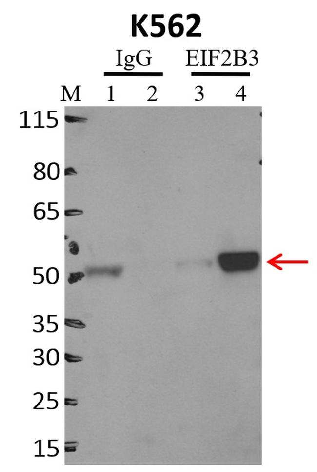 eIF2b gamma Antibody in RNA Immunoprecipitation (RIP)