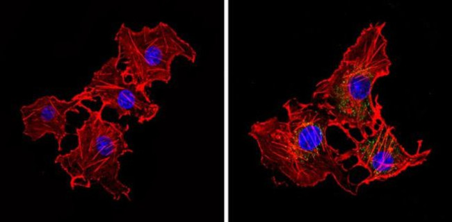 eIF2b gamma Antibody in Immunocytochemistry (ICC/IF)