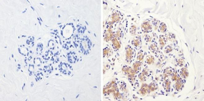 eIF2b gamma Antibody in Immunohistochemistry (Paraffin) (IHC (P))