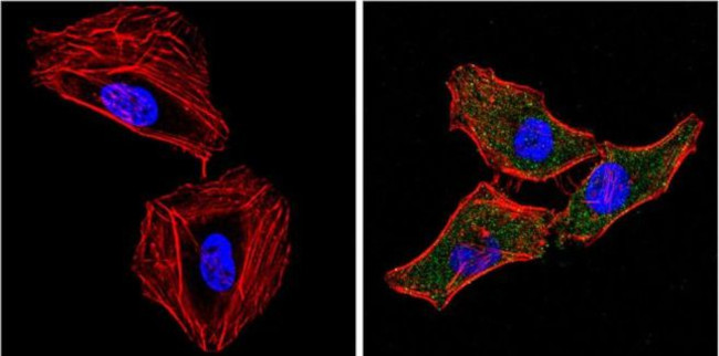 EIF2S1 Antibody in Immunocytochemistry (ICC/IF)