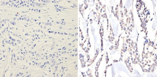 EIF2S1 Antibody in Immunohistochemistry (Paraffin) (IHC (P))