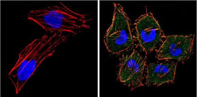 eIF4E Antibody in Immunocytochemistry (ICC/IF)