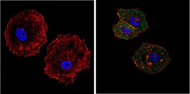 eIF4E Antibody in Immunocytochemistry (ICC/IF)