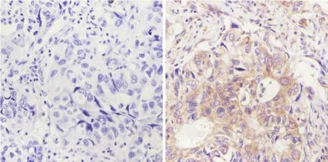 FOXA1 Antibody in Immunohistochemistry (Paraffin) (IHC (P))