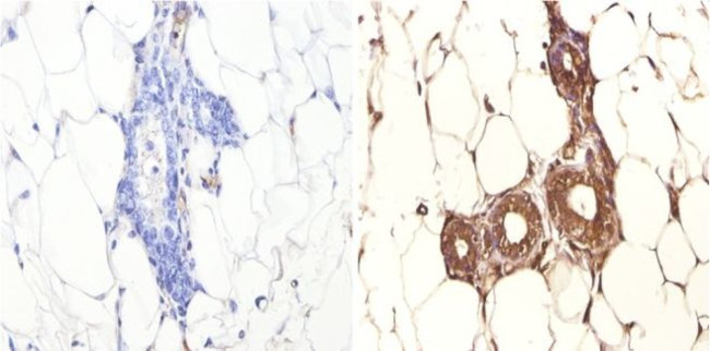 FOXA1 Antibody in Immunohistochemistry (Paraffin) (IHC (P))