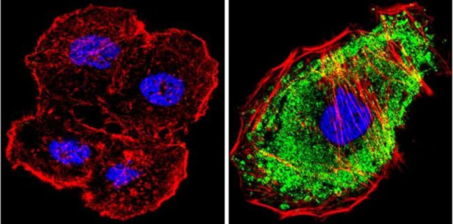 MEK1 Antibody in Immunocytochemistry (ICC/IF)