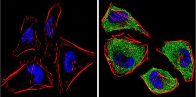 MEK1 Antibody in Immunocytochemistry (ICC/IF)