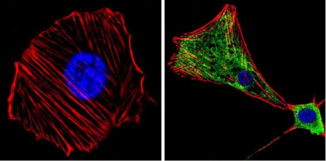 MEK1 Antibody in Immunocytochemistry (ICC/IF)