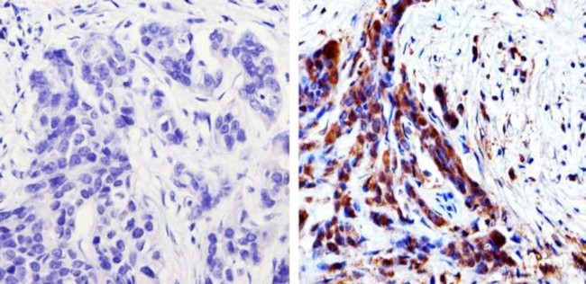 MEK1 Antibody in Immunohistochemistry (Paraffin) (IHC (P))