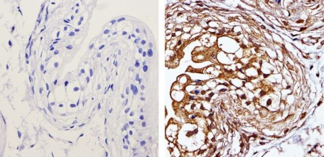 MEK1 Antibody in Immunohistochemistry (Paraffin) (IHC (P))