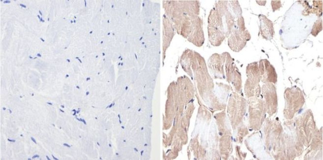 ERK2 Antibody in Immunohistochemistry (Paraffin) (IHC (P))