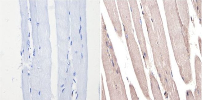 ERK2 Antibody in Immunohistochemistry (Paraffin) (IHC (P))