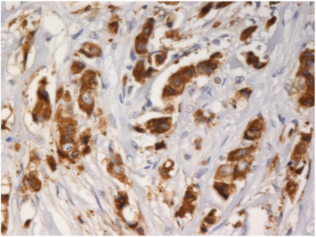 AGR3 Antibody in Immunohistochemistry (Paraffin) (IHC (P))