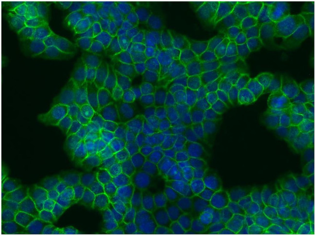 beta Catenin Antibody in Immunocytochemistry (ICC/IF)