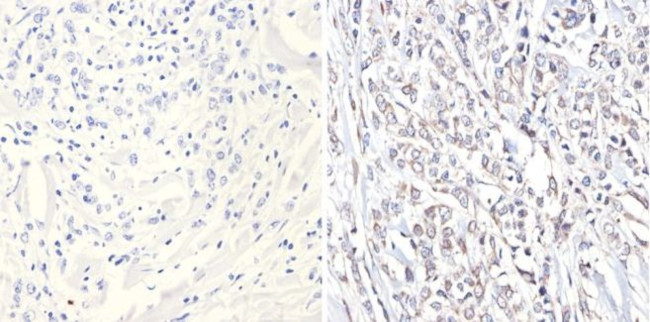 p38 MAPK gamma Antibody in Immunohistochemistry (Paraffin) (IHC (P))