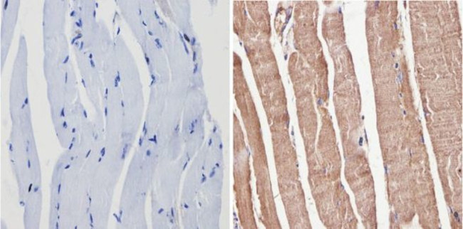 p38 MAPK gamma Antibody in Immunohistochemistry (Paraffin) (IHC (P))