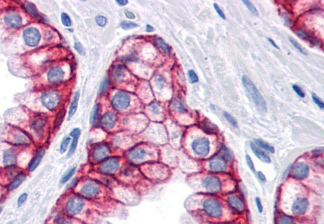 EpCAM Antibody in Immunohistochemistry (Paraffin) (IHC (P))