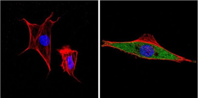 ERK3 Antibody in Immunocytochemistry (ICC/IF)